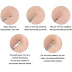 Pink Line Blackhead Remover Tool Kit - 4 in 1 Acne and Pimple Removal Tool - Nose & Face Blackheads Remover & White Heads Removal, Acne Removal Tool, Tweezers, Rose Gold - Image 5