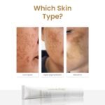 Personal Touch Melakey Radiance Cream for Hyperpigmentation & Melasma | 20gm | Pigmentation Removal Cream | 5% Azelaic Acid | Dark Spot Corrector with Glycolic Acid & Niacinamide for Even Skin Tone | Depigmentation - Image 5