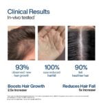 WishCare Hair Growth Serum For Scalp | 94% Saw New Hair Growth | Redensyl & Rosemary Oil | 100% Saw Hairfall Reduction | In-Vivo Tested | For Men & Women | 30ml - Image 3