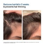 WishCare Hair Growth Serum For Scalp | 94% Saw New Hair Growth | Redensyl & Rosemary Oil | 100% Saw Hairfall Reduction | In-Vivo Tested | For Men & Women | 30ml - Image 5