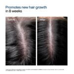WishCare Hair Growth Serum For Scalp | 94% Saw New Hair Growth | Redensyl & Rosemary Oil | 100% Saw Hairfall Reduction | In-Vivo Tested | For Men & Women | 30ml - Image 6