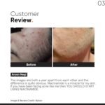 Minimalist 10% Niacinamide Serum with Zinc – Reduces Acne Marks, Controls Oil & Minimizes Pores | Vitamin B3 for Blemish-Free, Clear Skin | For Oily & Acne-Prone Skin (10 ml) - Image 7